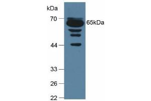 Detection of C9 in Mouse Serum using Polyclonal Antibody to Complement Component 9 (C9)