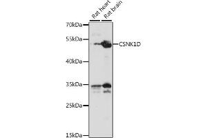 Western blot analysis of extracts of various cell lines, using CSNK1D antibody (ABIN7266100) at 1:1000 dilution. (Casein Kinase 1 delta Antikörper  (AA 250-350))