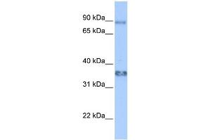 WB Suggested Anti-ZFP64 Antibody Titration:  0. (ZFP64 Antikörper  (Middle Region))