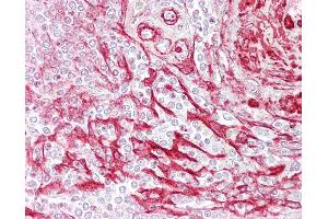 Anti-TAGLN / SM22 antibody IHC of human spleen. (Transgelin Antikörper  (C-Term))