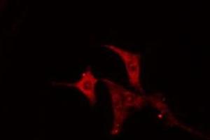 ABIN6274992 staining NIH-3T3 cells by IF/ICC.