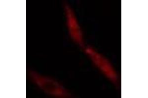 ABIN6274978 staining  Hela cells by IF/ICC. (CNOT4 Antikörper  (N-Term))