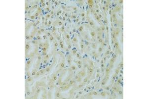 Immunohistochemistry of paraffin-embedded mouse kidney using RCC1 antibody (ABIN5973761) at dilution of 1/100 (40x lens). (RCC1 Antikörper)