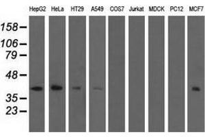 Western blot analysis of extracts (35 µg) from 9 different cell lines by using anti-SH3GL1 monoclonal antibody. (SH3GL1 Antikörper)