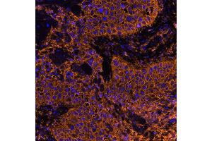 Immunofluorescence (IF) image for anti-CD44 (CD44) (AA 700-742) antibody (ABIN7454002) (Rekombinanter CD44 Antikörper  (AA 700-742))