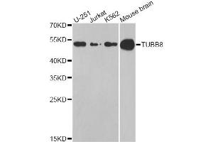 Western blot analysis of extracts of various cell lines, using TUBB8 antibody (ABIN5974843) at 1/1000 dilution. (Tubulin, beta 8 Antikörper)