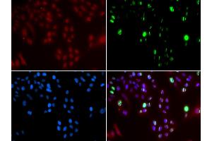 Immunofluorescence analysis of GFP-RNF168 transgenic U2OS cells using FANCD2 antibody (ABIN5971101). (FANCD2 Antikörper)
