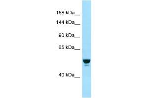 Western Blotting (WB) image for anti-RAB GTPase Activating Protein 1 (RABGAP1) (N-Term) antibody (ABIN2499655) (RABGAP1 Antikörper  (N-Term))