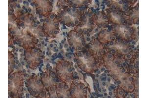 Immunohistochemistry (IHC) image for anti-Microtubule-Associated Protein 1A (MAP1A) (AA 2552-2759) antibody (ABIN7431635)