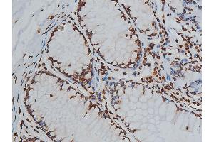 ABIN6267568 at 1/200 staining human colon tissue sections by IHC-P. (Histone 3 Antikörper  (H3K9ac))