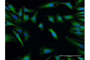 Immunofluorescence of purified MaxPab antibody to SH3GLB2 on HeLa cell. (SH3GLB2 Antikörper  (AA 1-395))