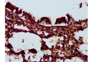 IHC image of ABIN7157204 diluted at 1:200 and staining in paraffin-embedded human lung tissue performed on a Leica BondTM system. (Kallikrein 14 Antikörper  (AA 114-225))