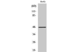 Western Blotting (WB) image for anti-Cathepsin E (CTSE) (Internal Region) antibody (ABIN3183693) (Cathepsin E Antikörper  (Internal Region))