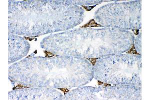 Immunohistochemistry (IHC) image for anti-N-Ethylmaleimide-Sensitive Factor (NSF) (AA 620-744) antibody (ABIN5693126)