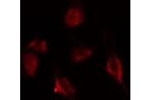ABIN6275397 staining  293 cells by IF/ICC. (DDX20 Antikörper  (Internal Region))