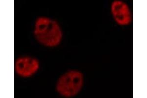 ABIN6269383 staining HeLa cells by IF/ICC. (ATRIP Antikörper  (N-Term))