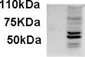 AP22454PU-N AIM2 antibody staining of IFNbeta-treated WI-38 lysate (35µg protein in RIPA buffer). (AIM2 Antikörper  (C-Term))