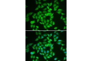 Immunofluorescence analysis of HeLa cells using CSNK1E antibody (ABIN6128970, ABIN6139116, ABIN6139117 and ABIN7101448). (CK1 epsilon Antikörper  (AA 247-416))