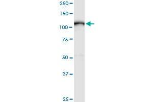 ADAM17 monoclonal antibody (M01), clone 1F6. (ADAM17 Antikörper  (AA 215-314))