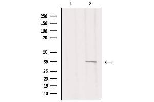 Western blot analysis of extracts from 293, using MSHR Antibody. (MC1 Receptor Antikörper  (C-Term))