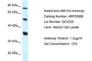 WB Suggested Anti-ZNF232 Antibody   Titration: 1. (ZNF232 Antikörper  (N-Term))