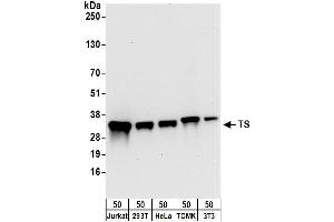 Western Blotting (WB) image for anti-TS (C-Term) antibody (ABIN7795593) (TS (C-Term) Antikörper)