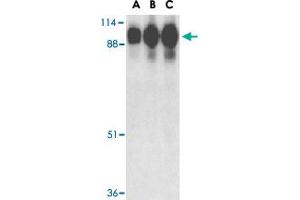Western blot analysis of ACE2 in human kidney tissue lysate with ACE2 polyclonal antibody  at (A) 0. (ACE2 Antikörper  (Internal Region))