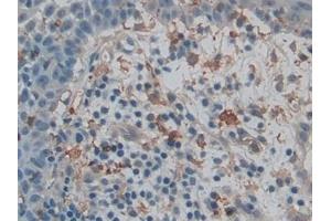 Immunohistochemistry (IHC) image for anti-Gelsolin (GSN) (AA 577-771) antibody (ABIN7442030)