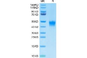 Biotinylated Human DKK1 on Tris-Bis PAGE under reduced condition. (DKK1 Protein (AA 32-266) (His-Avi Tag,Biotin))