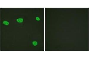 Immunofluorescence analysis of HeLa cells, using Vitamin D Receptor (Ab-208) Antibody.