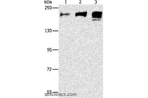 Western blot analysis of Human ileum adenocarcinoma tissue, Human testis and prostate tissue, using ACE Polyclonal Antibody at dilution of 1:240