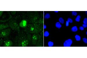 Immunofluorescence analysis of A431 cells using MKI67 antibody (ABIN5997055). (Ki-67 Antikörper)