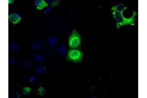 Image no. 5 for anti-Basigin (Ok Blood Group) (BSG) antibody (ABIN1498015) (CD147 Antikörper)