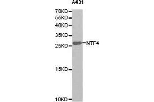 Western Blotting (WB) image for anti-Neurotrophin 4 (NTF4) antibody (ABIN1873968) (Neurotrophin 4 Antikörper)