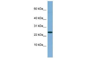 NBL1 antibody used at 1 ug/ml to detect target protein. (NBL1 Antikörper  (Middle Region))