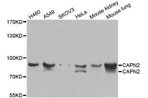 Western blot analysis of extracts of various cell lines, using CAPN2 antibody. (Calpain 2 Antikörper  (AA 350-680))