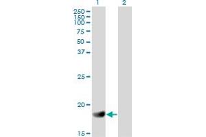 Western Blot analysis of RGS3 expression in transfected 293T cell line by RGS3 monoclonal antibody (M01), clone 1E8-C7. (RGS3 Antikörper  (AA 1-192))