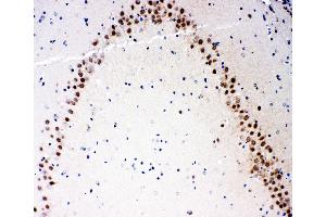 Anti-MEKK3 antibody, IHC(P) IHC(P): Rat Brain Tissue