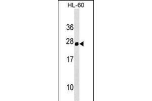Mouse Hoxc5 Antibody (C-term) (ABIN1536714 and ABIN2849346) western blot analysis in HL-60 cell line lysates (35 μg/lane). (Homeobox C5 Antikörper  (C-Term))