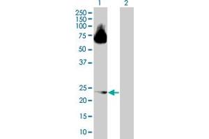 Western Blot analysis of ARL4D expression in transfected 293T cell line by ARL4D MaxPab polyclonal antibody.