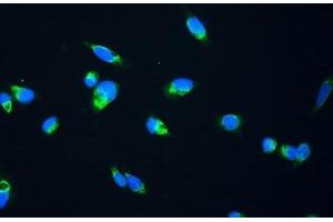 anti-Fumarate Hydratase (FH) antibody