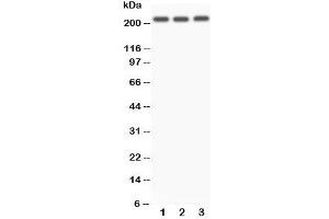 Western blot testing of NOTCH4 antibody and Lane 1:  A549;  2: SMMC-7721;  3: HeLa. (NOTCH4 Antikörper  (C-Term))