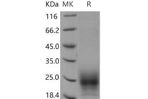 Western Blotting (WB) image for T Cell Immunoreceptor with Ig and ITIM Domains (TIGIT) (Active) protein (His tag) (ABIN7320104) (TIGIT Protein (His tag))
