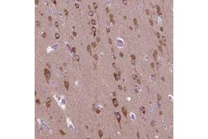 Immunohistochemical staining (Formalin-fixed paraffin-embedded sections) of human cerebral cortex with GAS7 polyclonal antibody  shows cytoplasmic positivity in neurons. (GAS7 Antikörper)