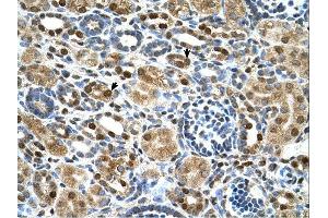 ZNF169 antibody was used for immunohistochemistry at a concentration of 4-8 ug/ml. (ZNF169 Antikörper  (Middle Region))