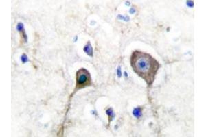 Image no. 1 for anti-S100 Calcium Binding Protein A1 (S100A1) antibody (ABIN271809) (S100A1 Antikörper)