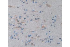 Immunohistochemistry (IHC) image for anti-Intercellular Adhesion Molecule 3 (ICAM3) (AA 46-197) antibody (ABIN5013759)
