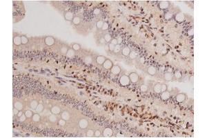 ABIN6269133 at 1/200 staining Rat intestinal tissue sections by IHC-P. (KIT Antikörper  (Internal Region))