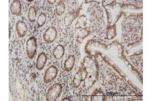 Immunoperoxidase of monoclonal antibody to LHX4 on formalin-fixed paraffin-embedded human small Intestine. (LHX4 Antikörper  (AA 291-390))