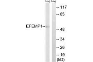 Western blot analysis of extracts from rat lung, using EFEMP1 Antibody. (FBLN3 Antikörper  (AA 111-160))